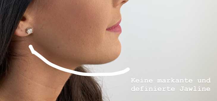 Jawline Contouring mit Filler Radiesse®